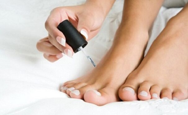 Genezende vernis van nagelschimmel