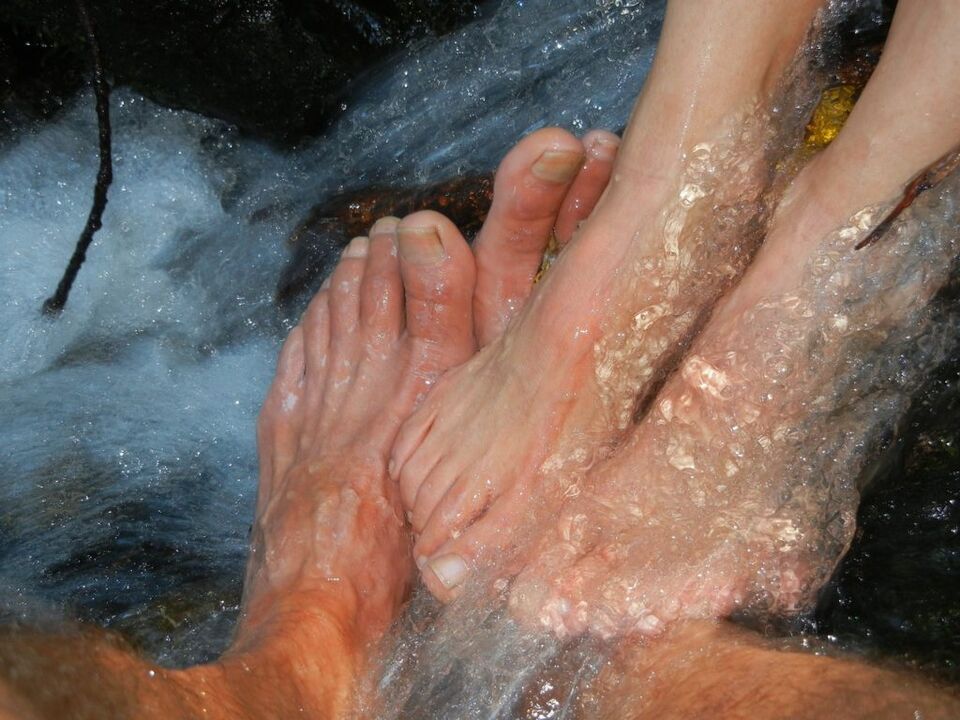 Mycosis van de nagels van de benen